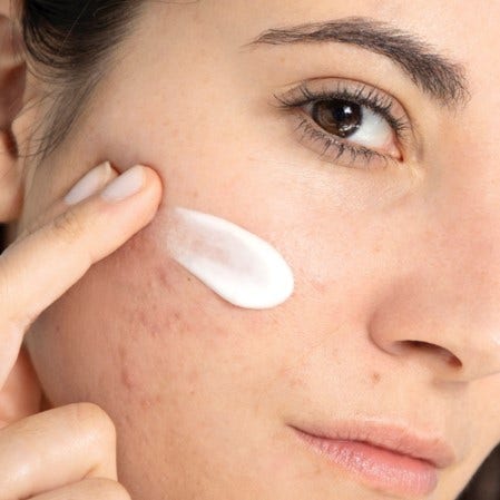 crème peau irritée